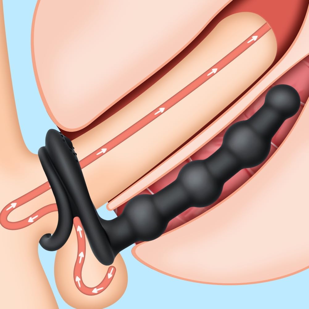 Penisring Anal Vibrator mit Fernbedienung Silikon Cockring Analkugeln 10 Vibrationsmodi Penis Ring Stimulator Anal Dildo Butt Plug Extreme Sexspielzeuge für Männer Frauen und Paare